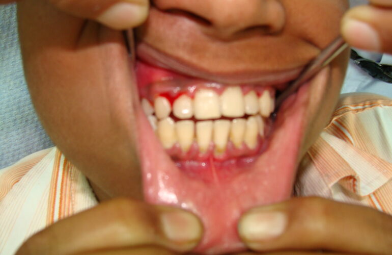 Photo credit: Dr Parveen Chopra on Visualhunt